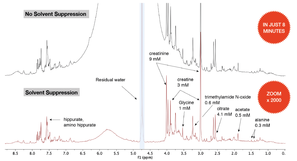 Benchtop-NMR-Spectroscopy-Urine-Spectrum-Spinsolve-Magritek-1