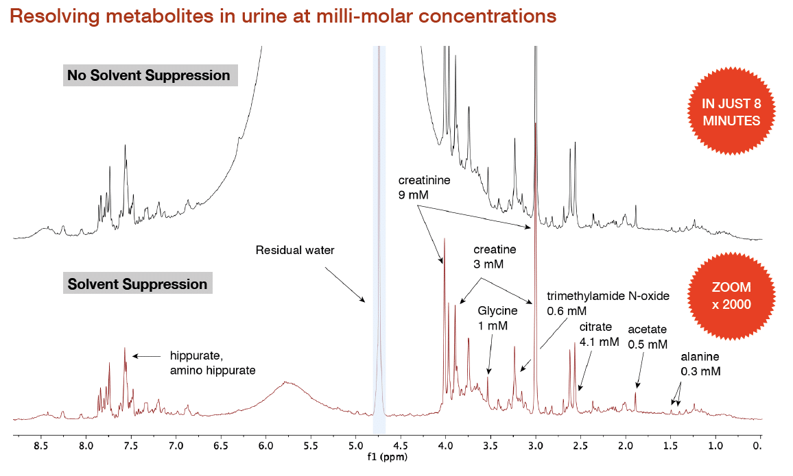 Benchtop-NMR-Spectroscopy-Urine-Spectrum-Spinsolve-Magritek